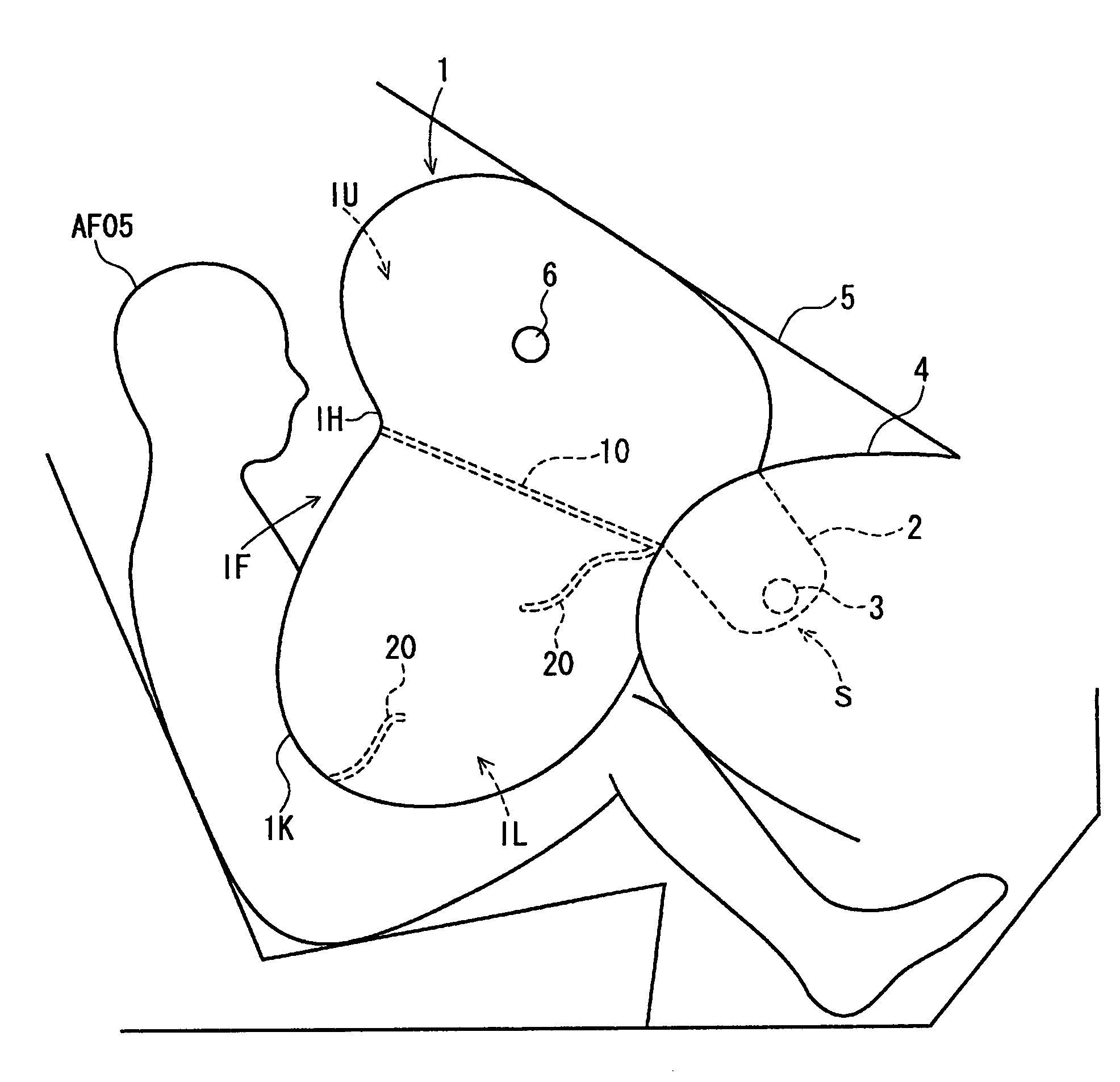 Airbag and airbag device