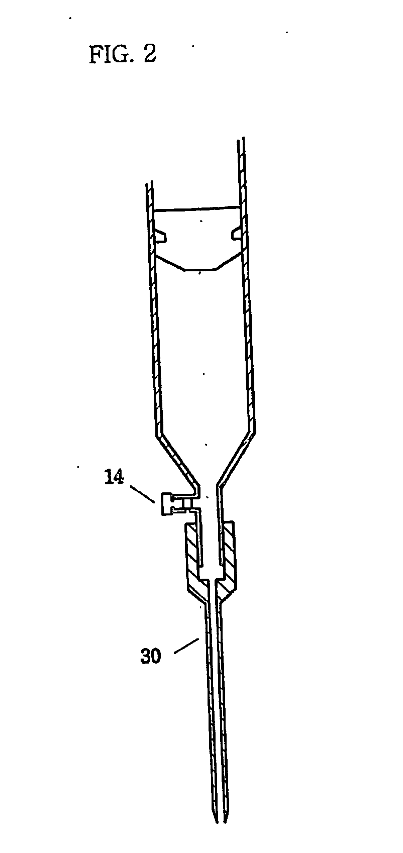 Closed loop fat transplantation system