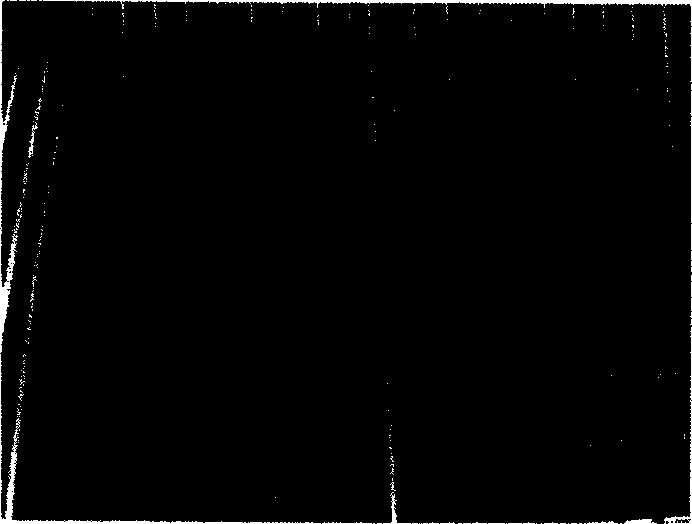 Application of astragaloside in medicine for treating or preventing insulin resistance