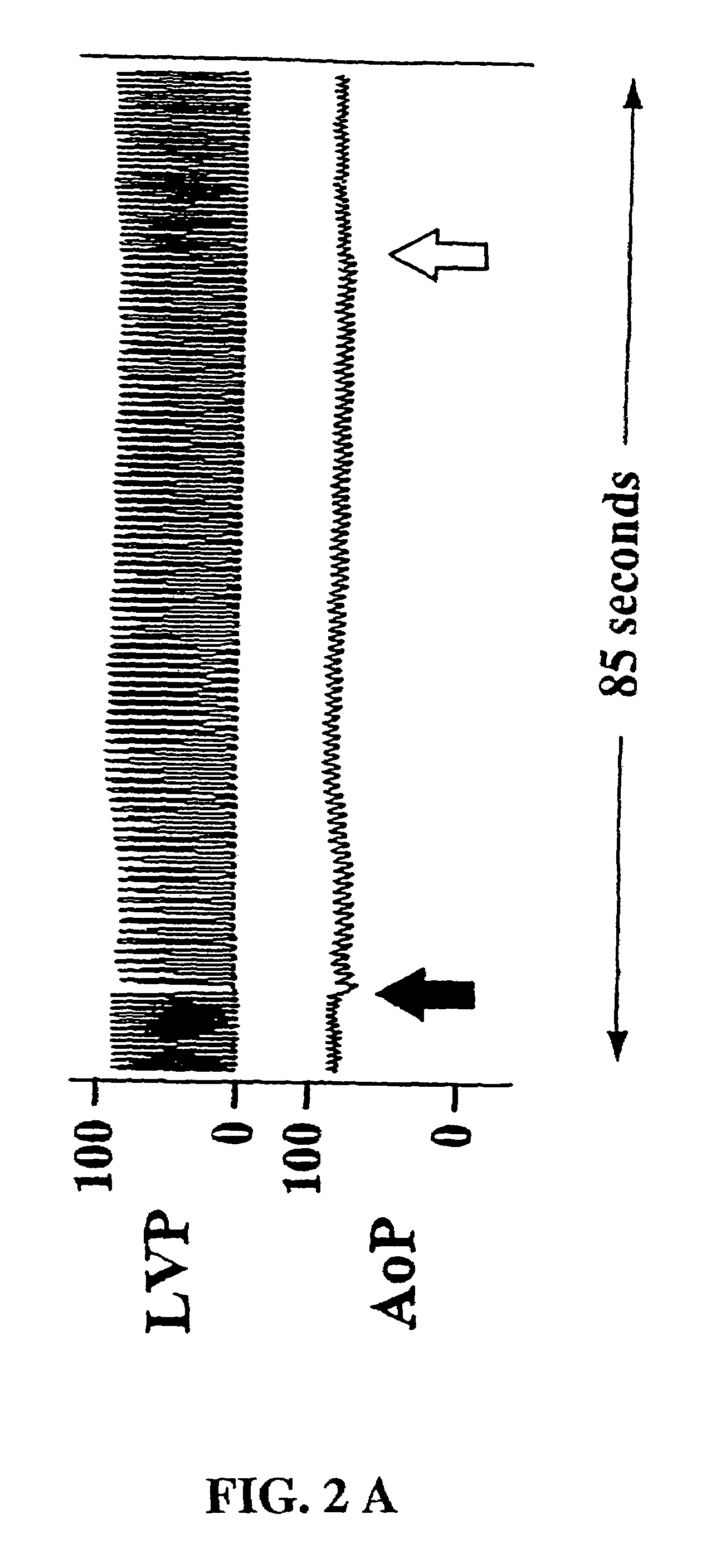 Methods of indirectly stimulating the vagus nerve with an electrical field