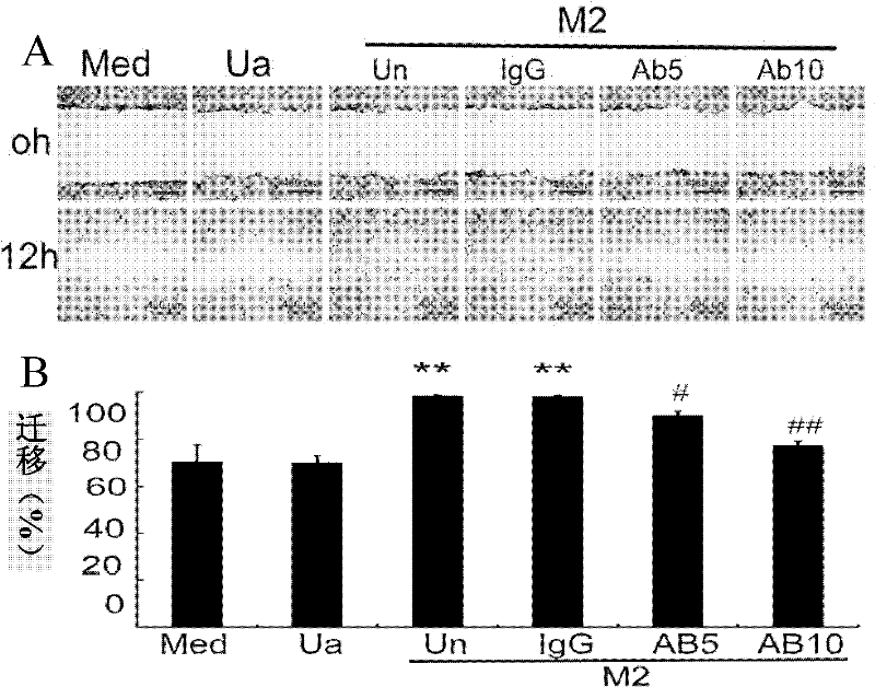 Application of PITPNM3 gene in preparing medicine for inhibiting breast cancer invasion and transfer