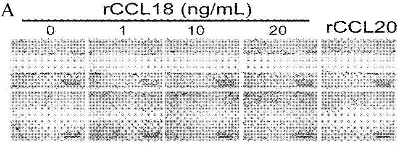 Application of PITPNM3 gene in preparing medicine for inhibiting breast cancer invasion and transfer