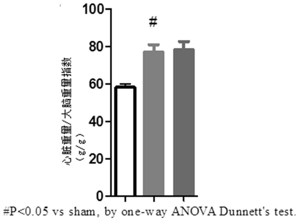 Application of ester group-containing aromatic propionamide compound and metabolites thereof in preparation of drugs for treating heart failure