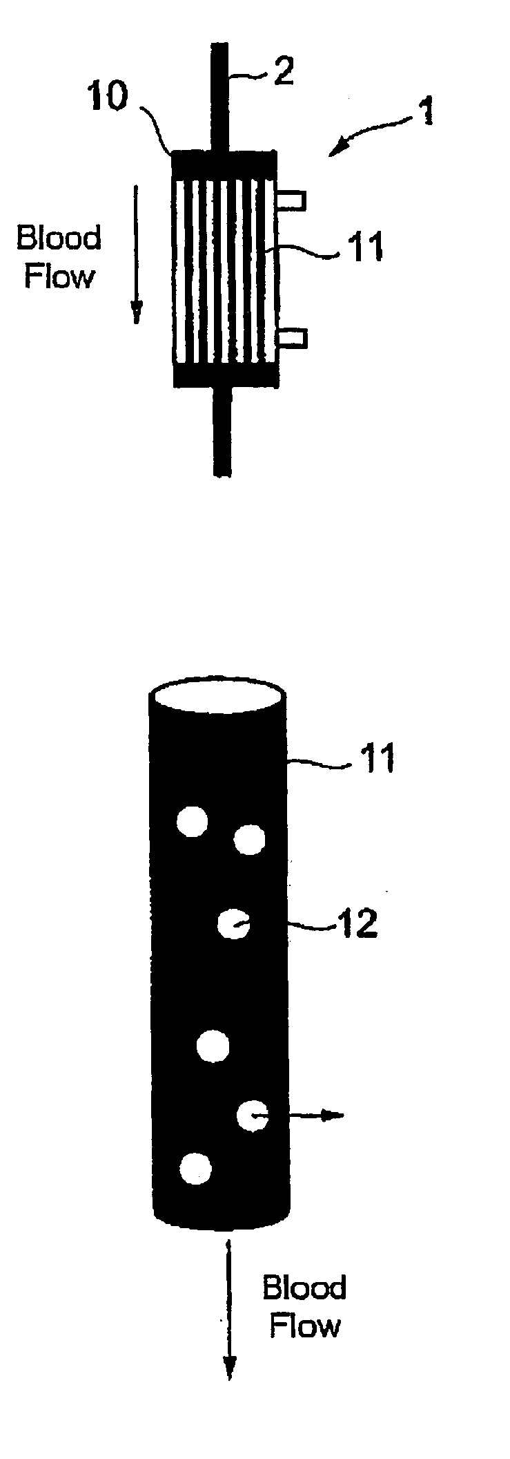 Method for calculating filter clogging factor and bed-side system