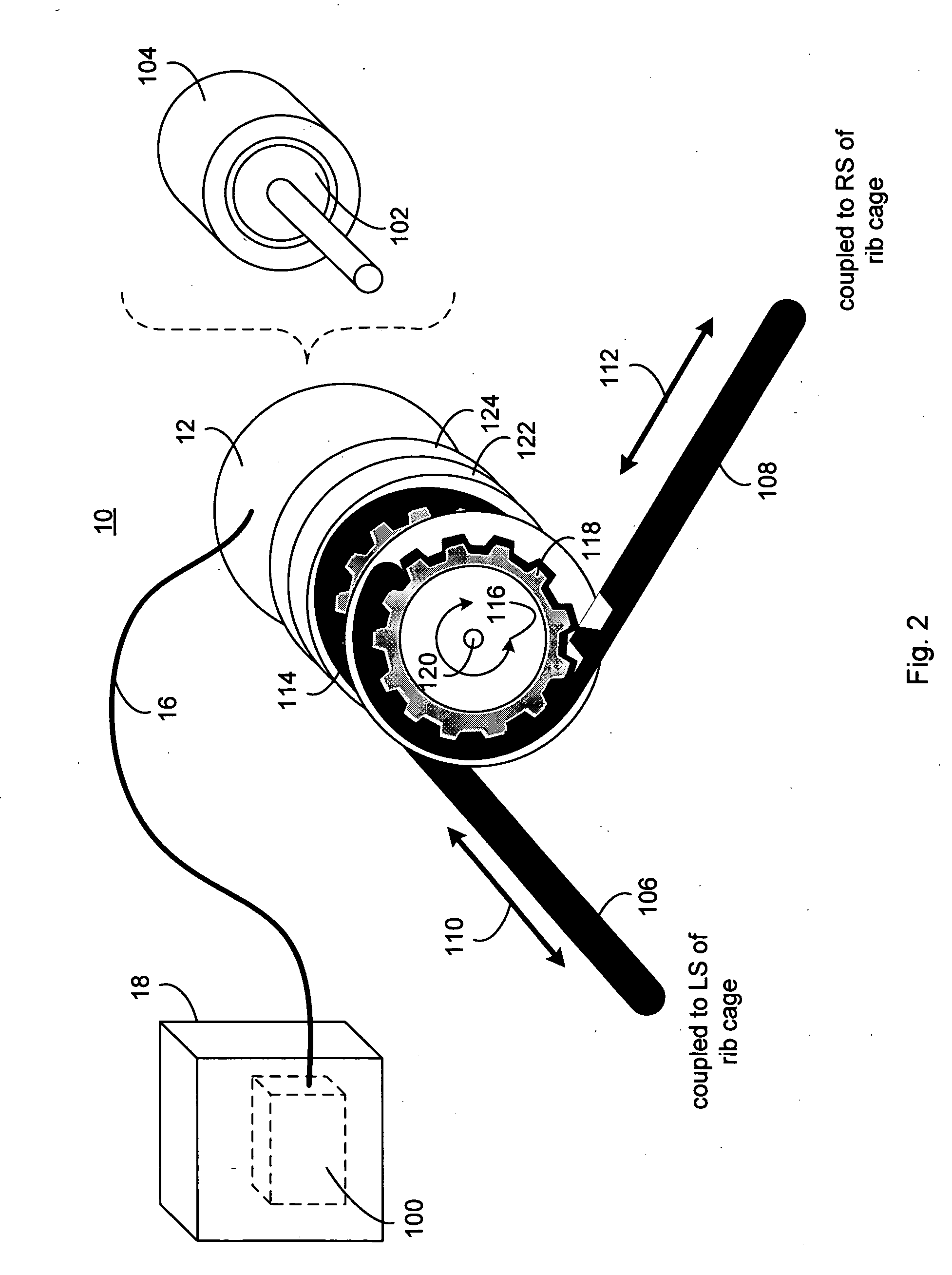 Implantable generating system