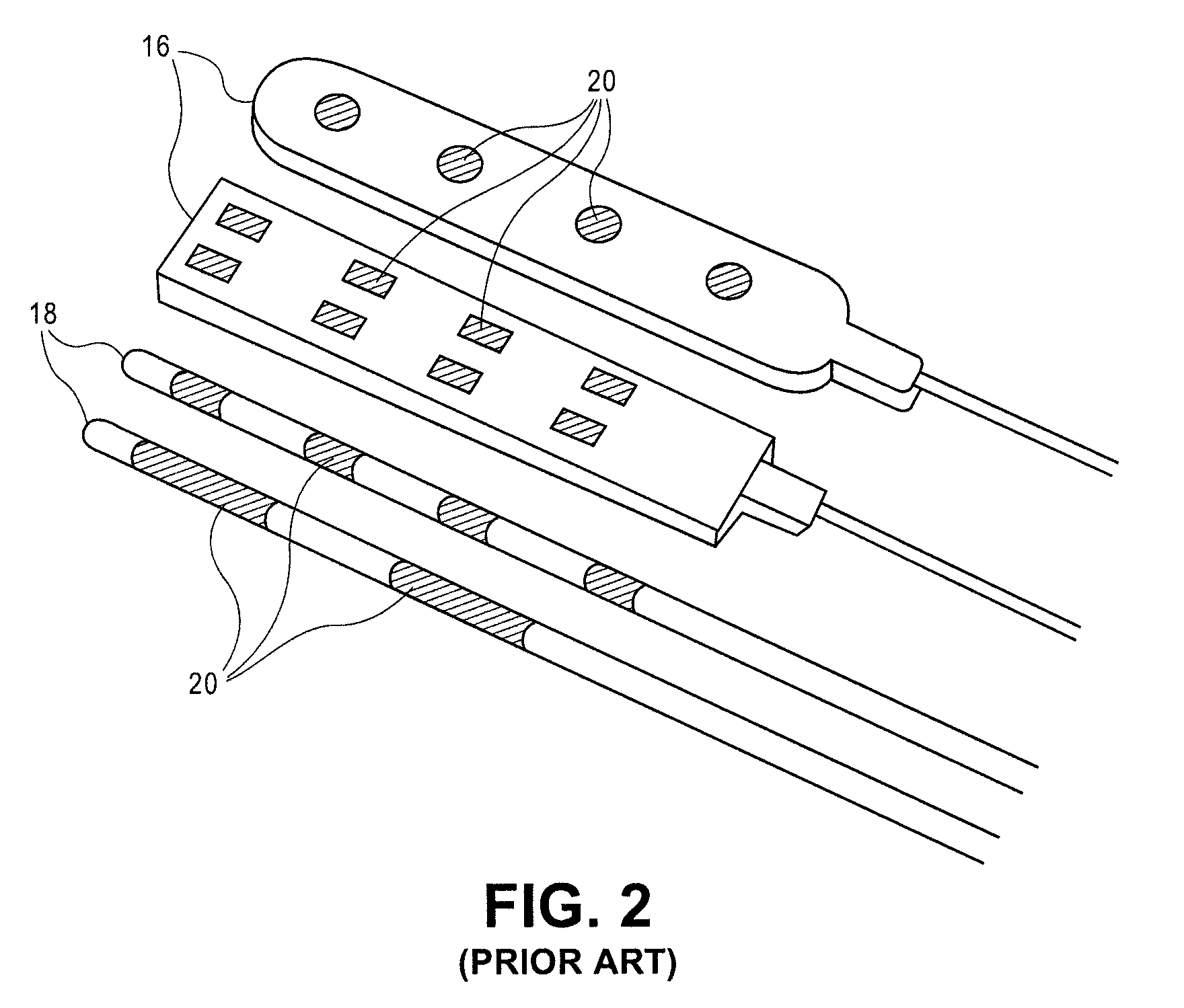 Expandable stimulation leads and methods of use