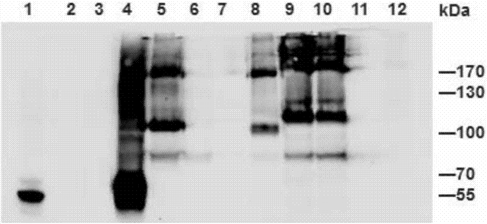 Anti-Ebola virus neutralizing monoclonal antibody