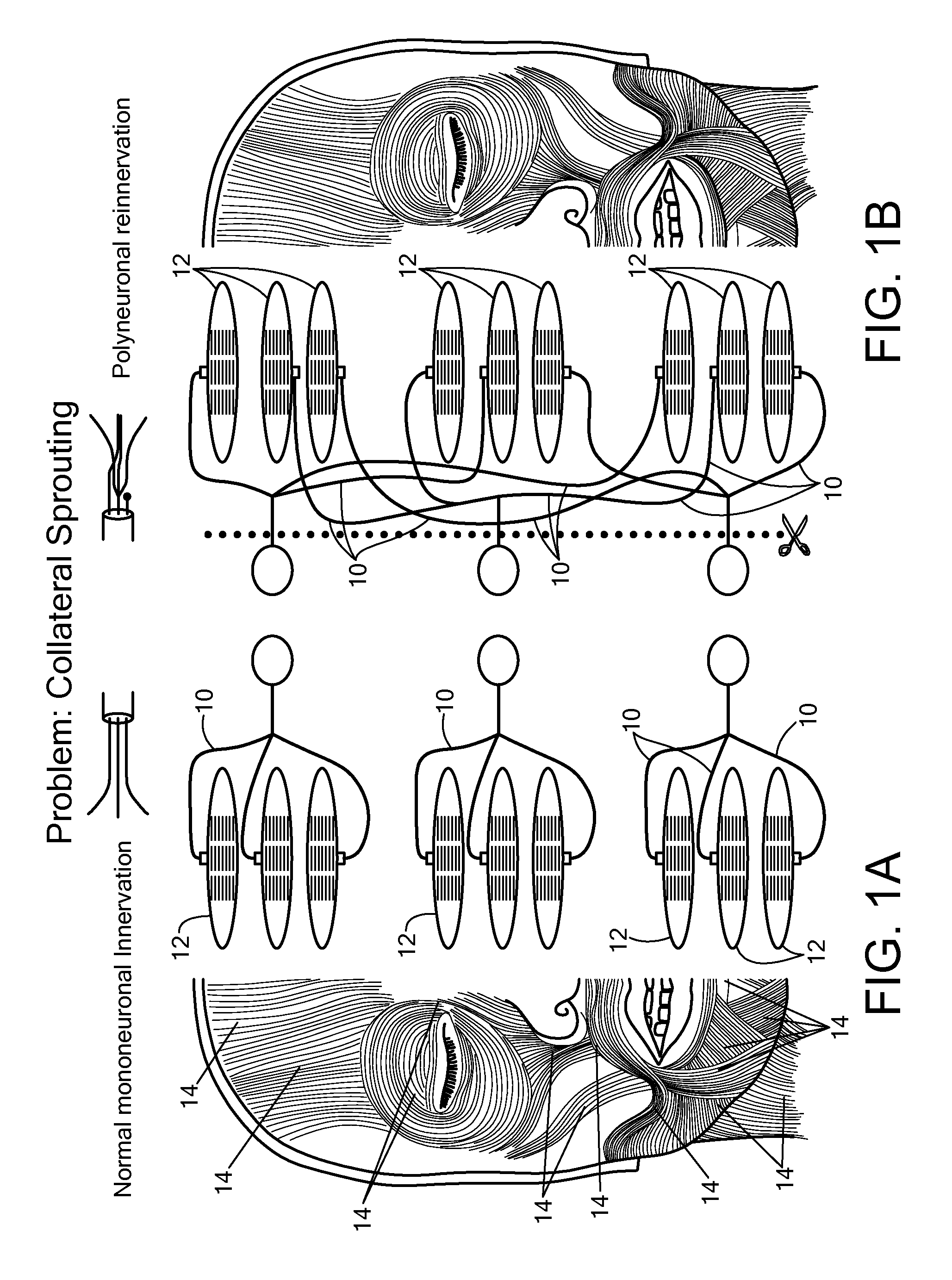 System and method for facial nerve stimulation