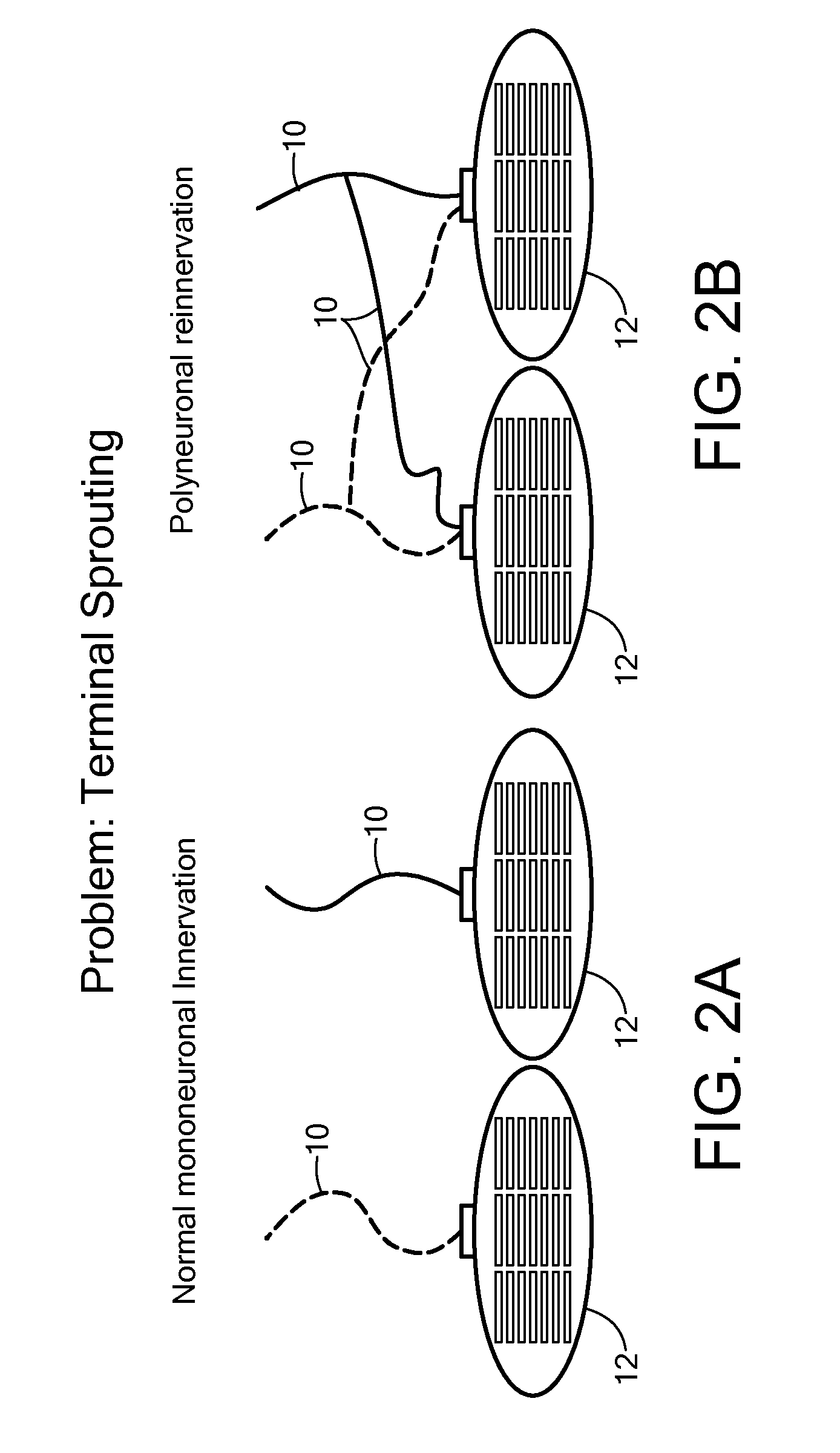 System and method for facial nerve stimulation