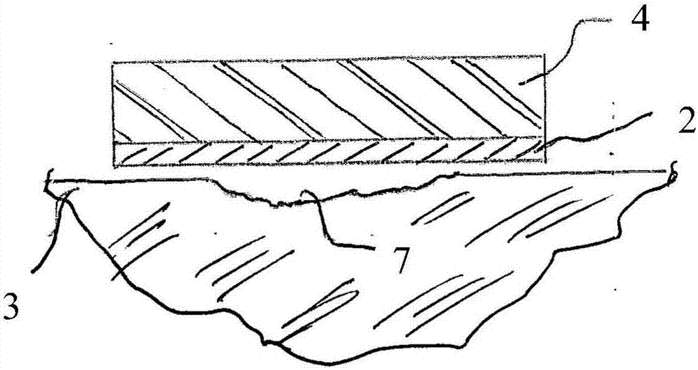 Device for wound dressing"