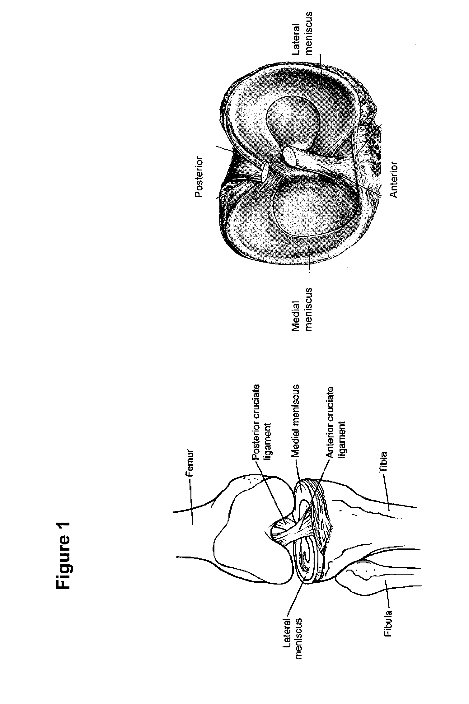 Fiber-Hydrogel Composite for Tissue Replacement