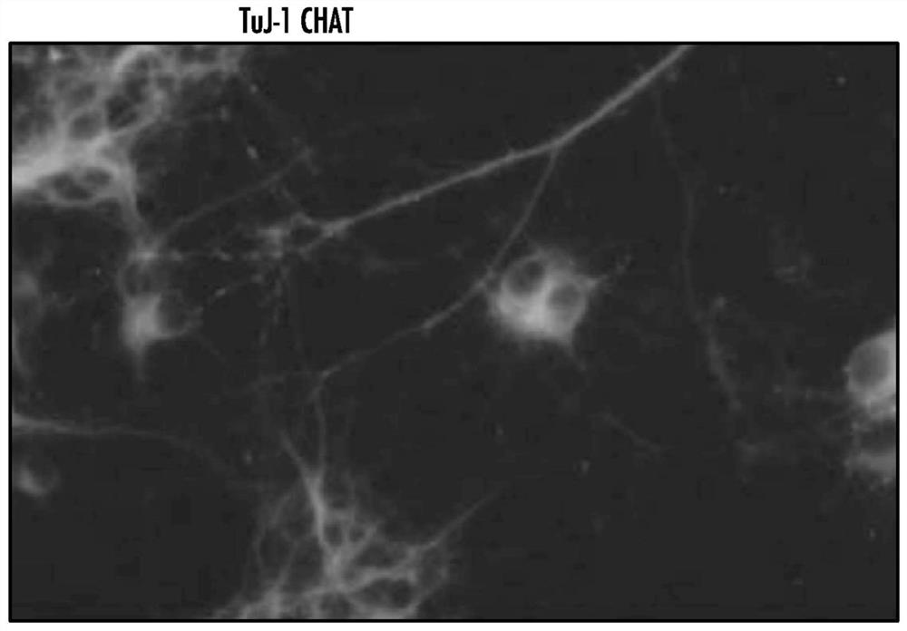 Methods of treating or preventing amyotrophic lateral sclerosis