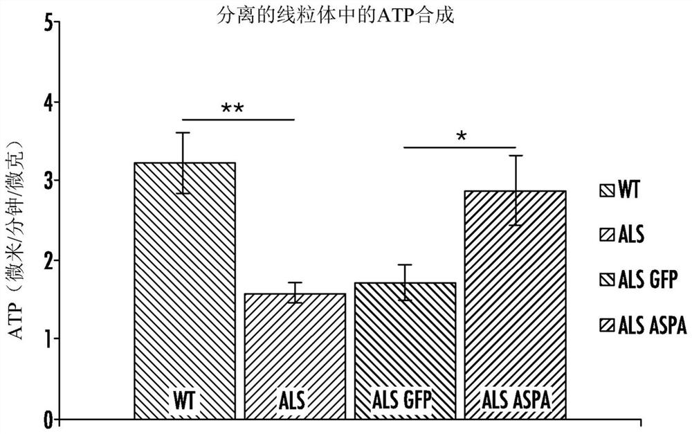 Methods of treating or preventing amyotrophic lateral sclerosis