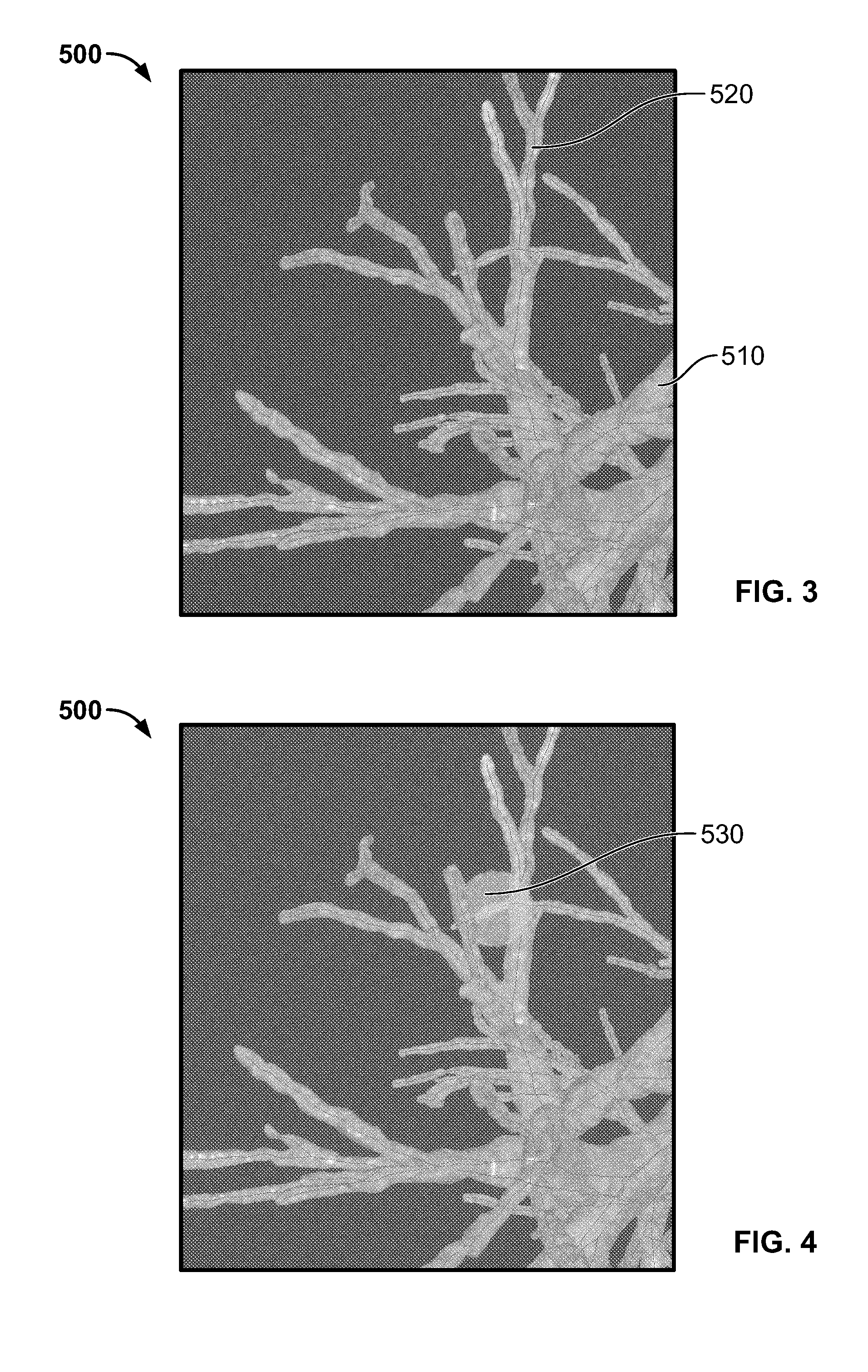 Automated fiducial marker planning system and related methods