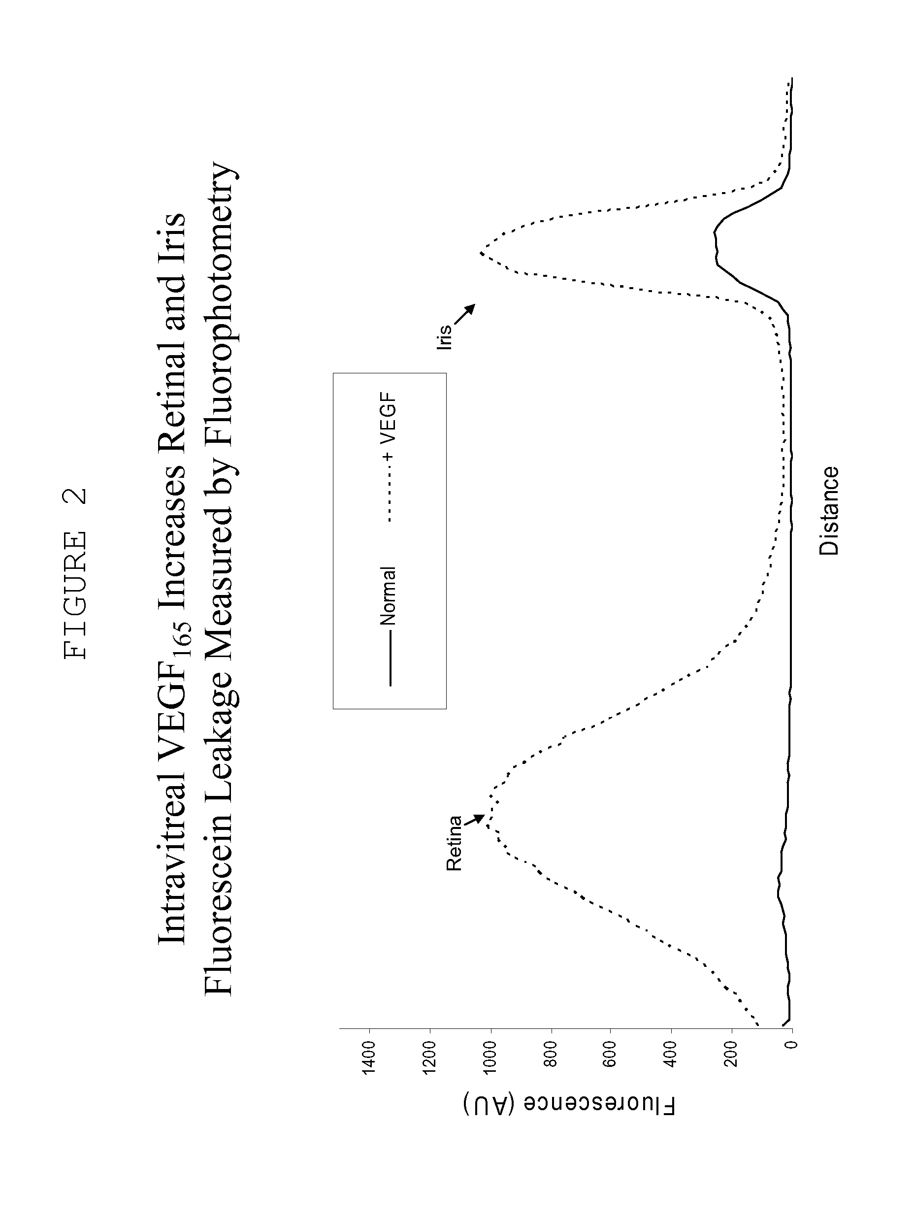 Ocular therapy using glucocorticoid derivatives selectively penetrating posterior segment tissues