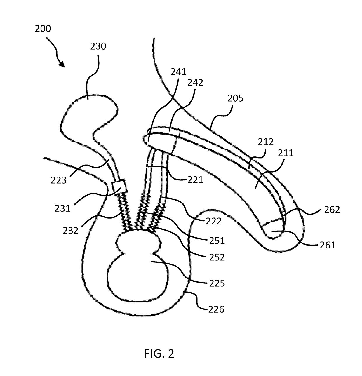 Penile implant with a length-adjustable tube