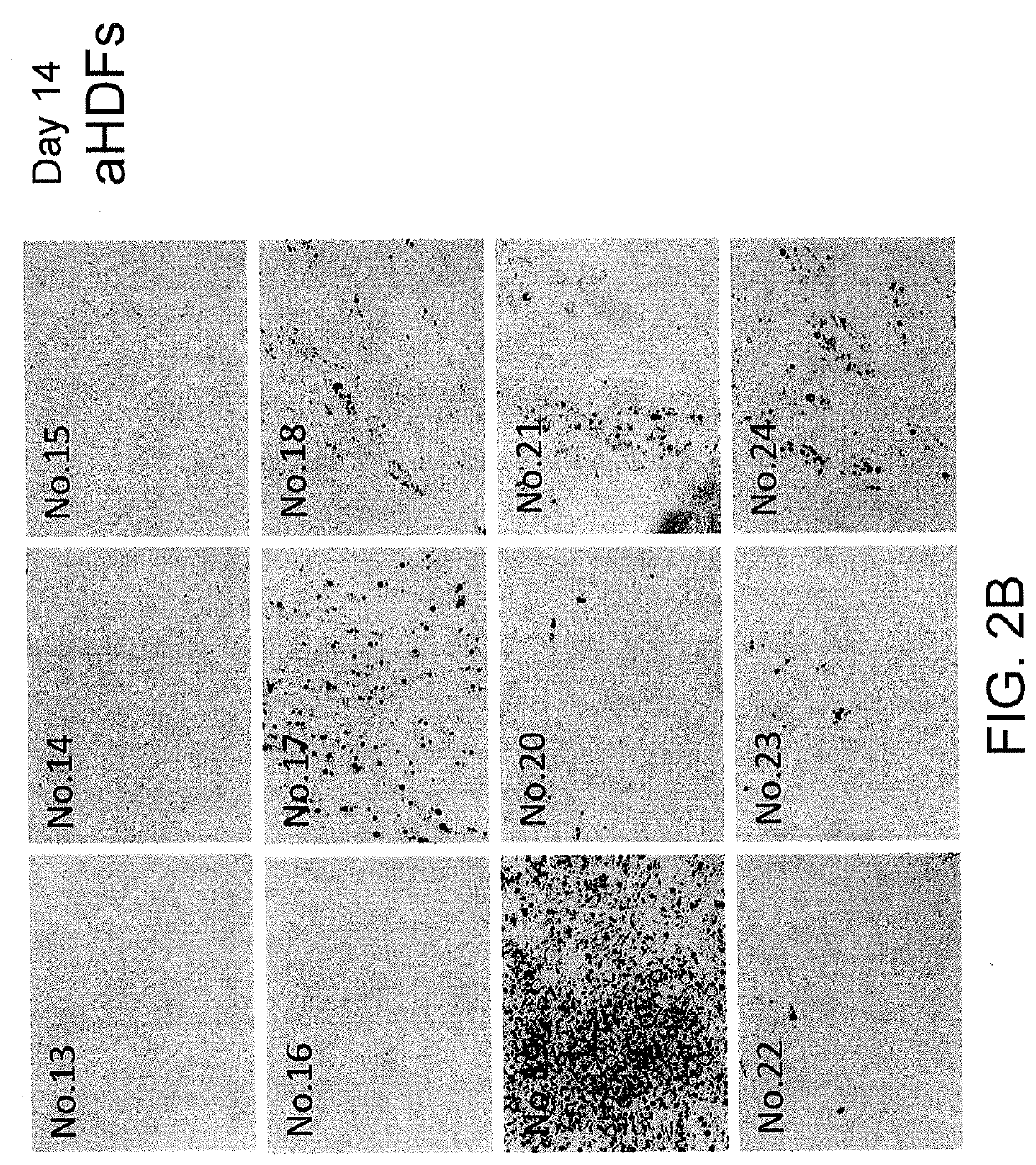 Brown fat cells and method for preparing same