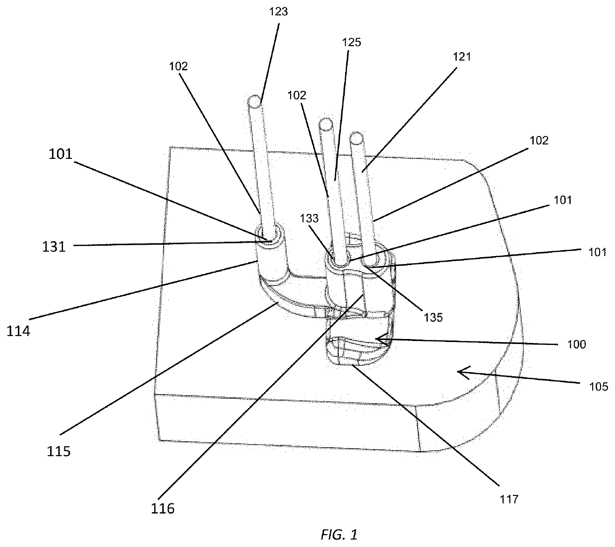 Bone displacement system and method