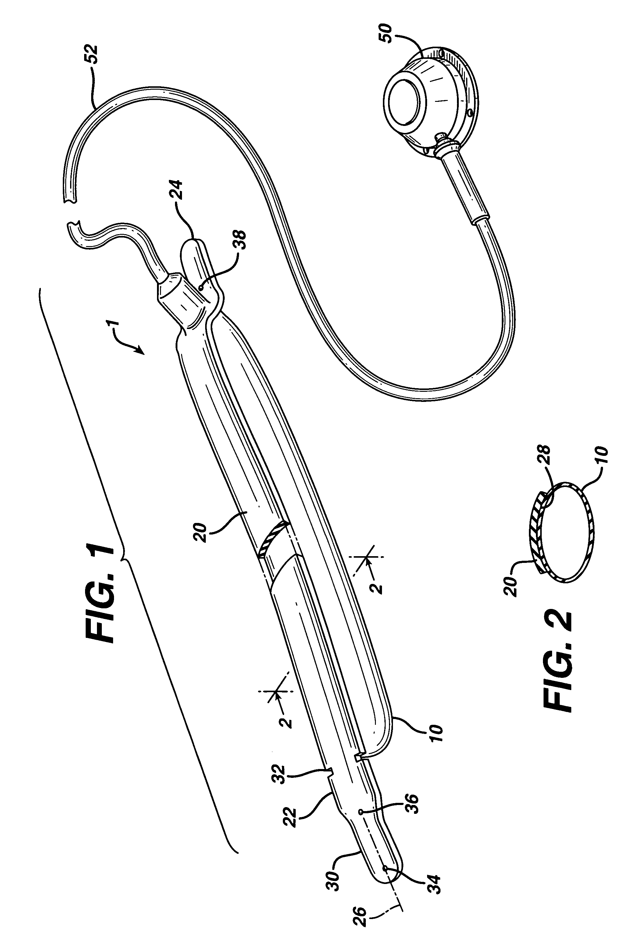 Method for implanting an adjustable band