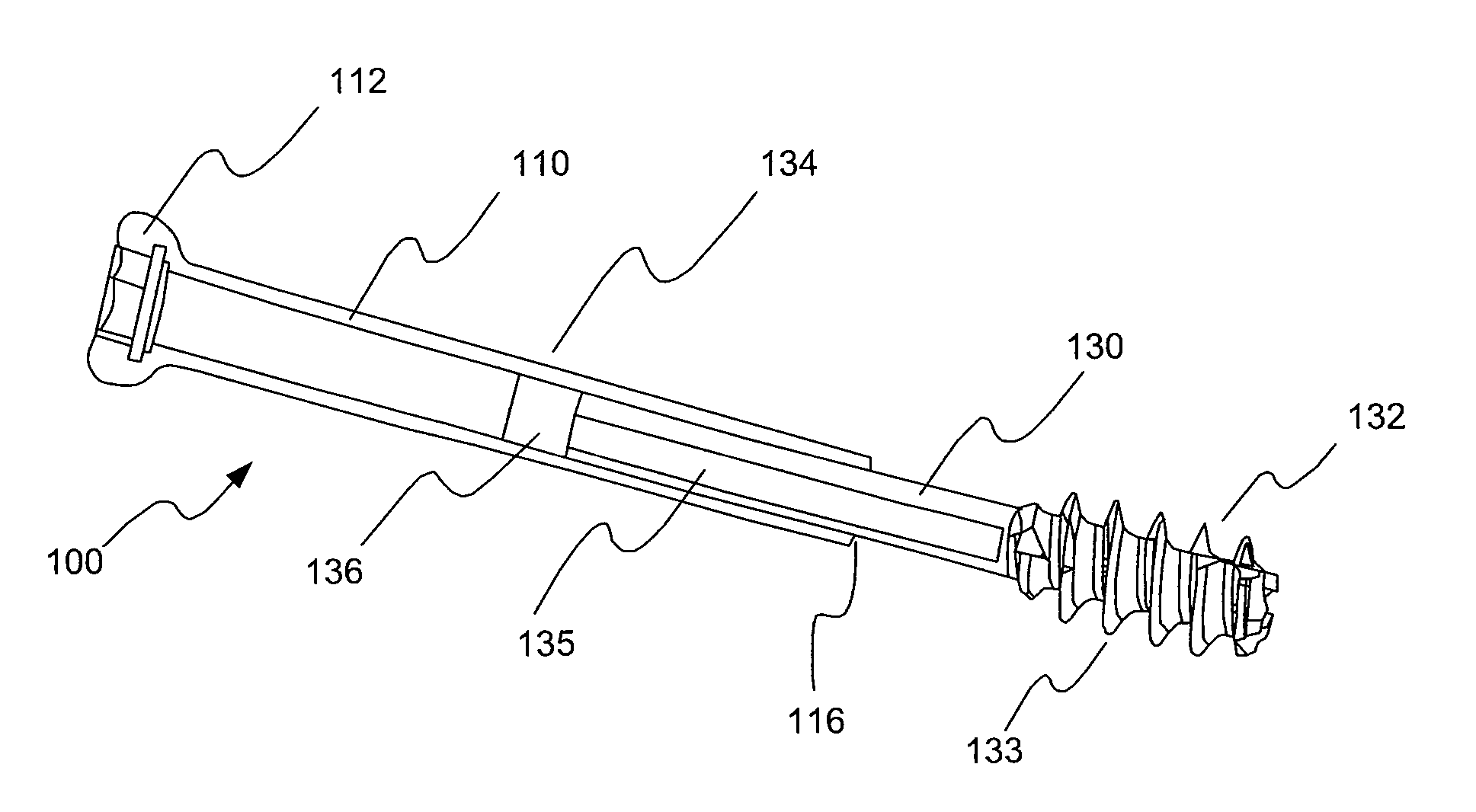 Bone screw system and method for the fixation of bone fractures