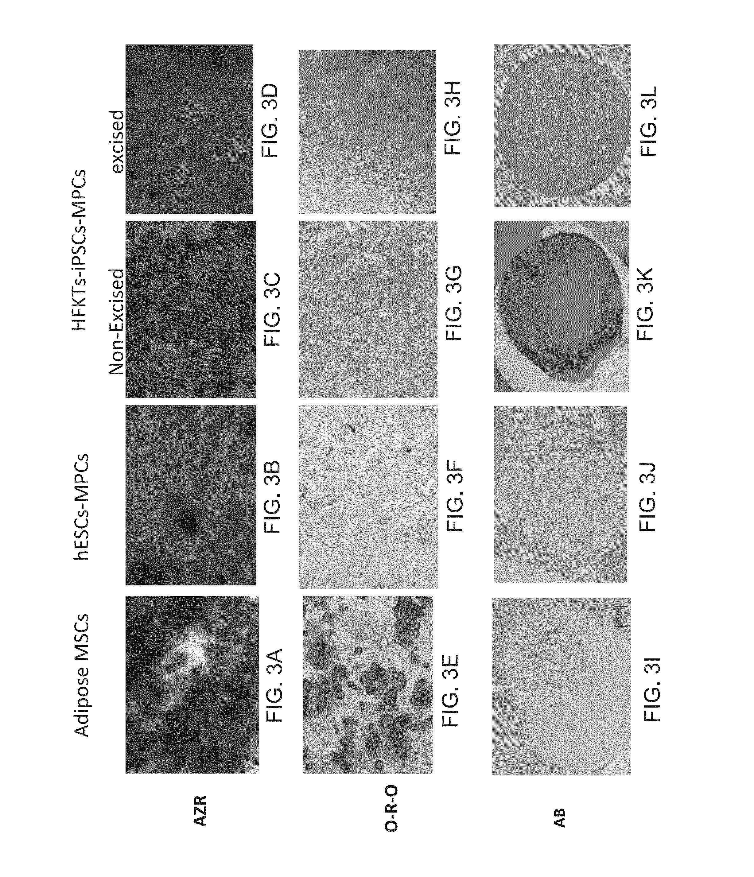 Isolated mesenchymal progenitor cells and extracellular matrix produced thereby