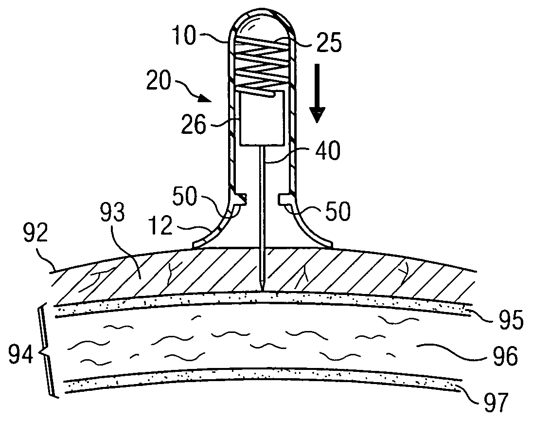 Apparatus and method for accessing the bone marrow