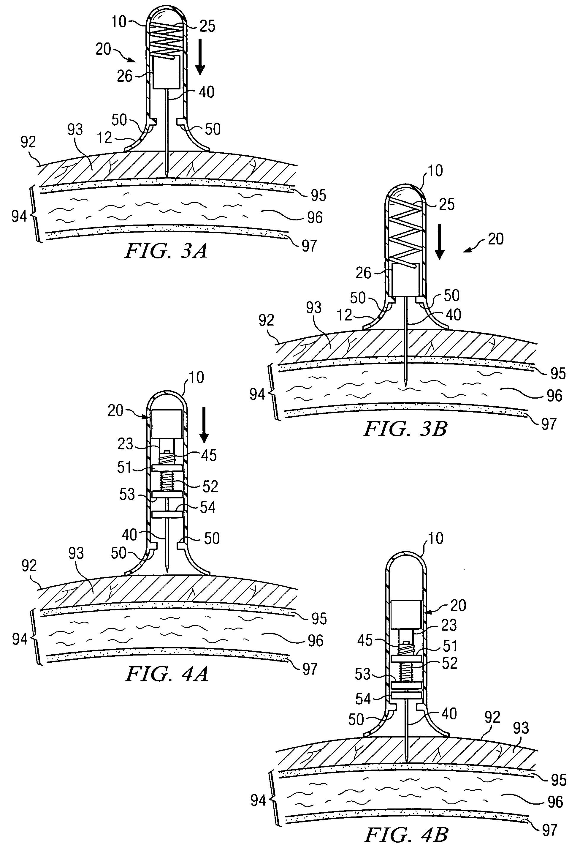 Apparatus and method for accessing the bone marrow