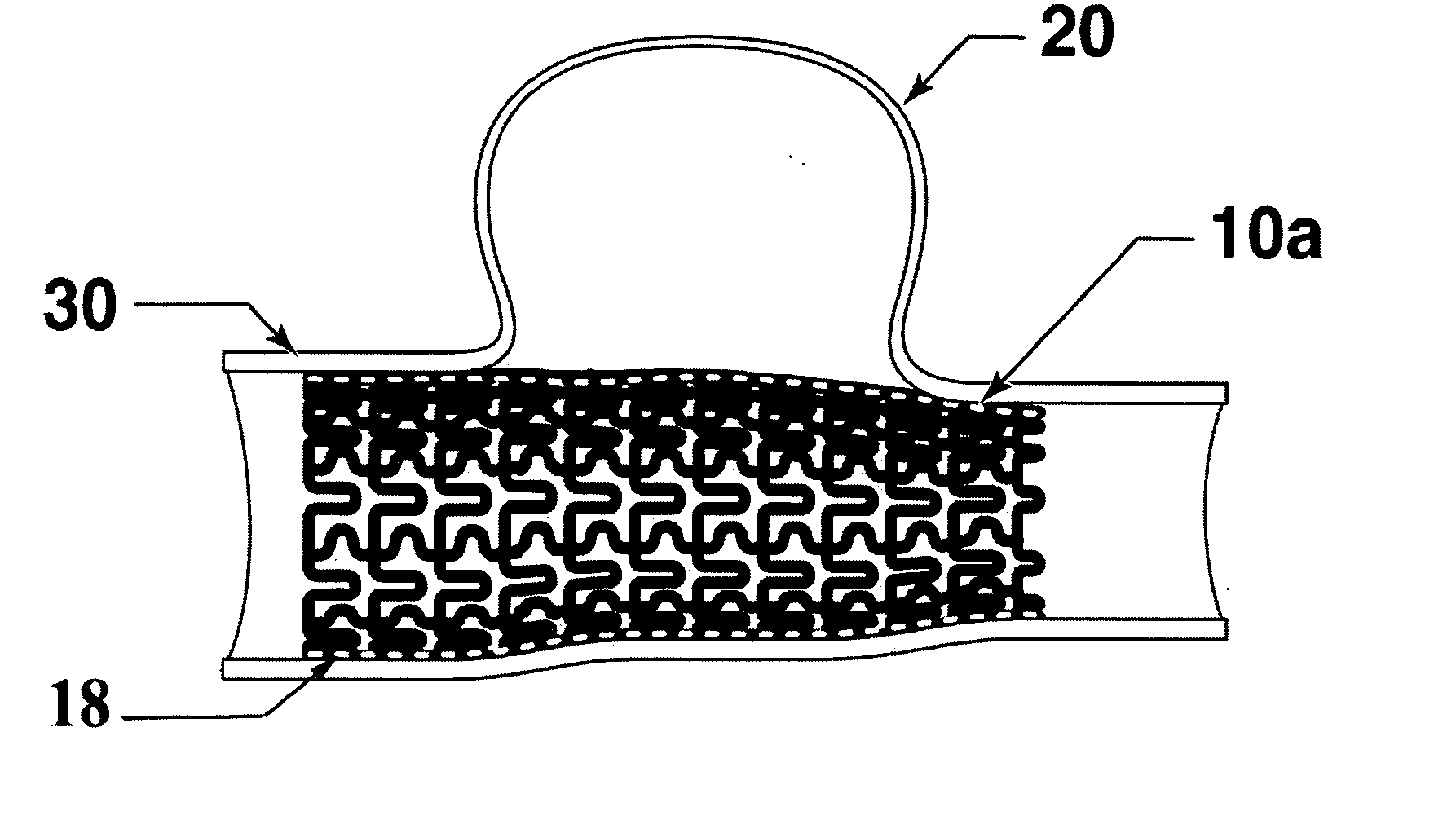 Micro-pleated stent assembly