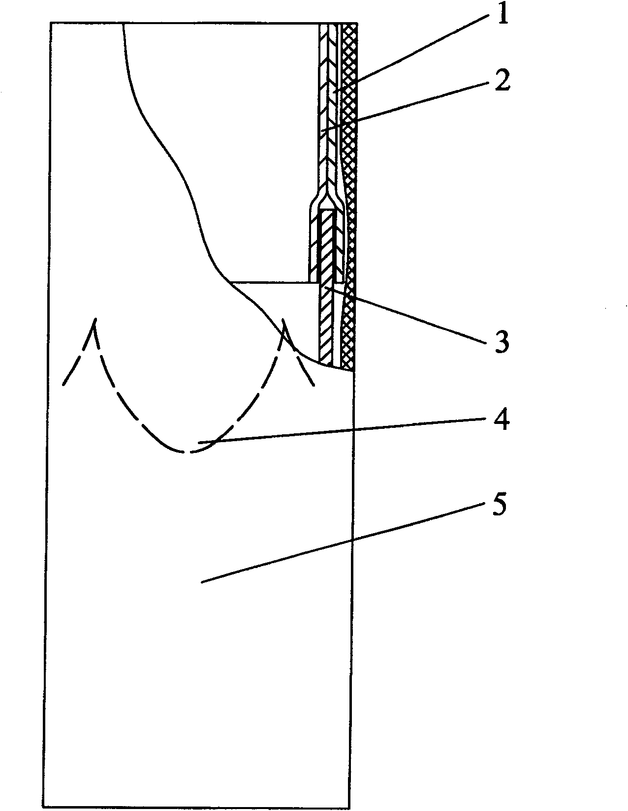 Artificial pulmonary artery with valve