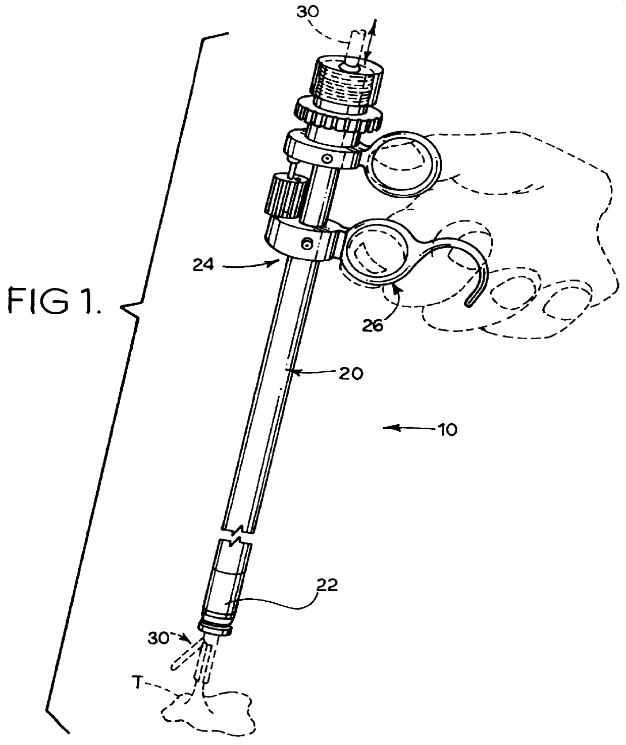 Surgical loop delivery device