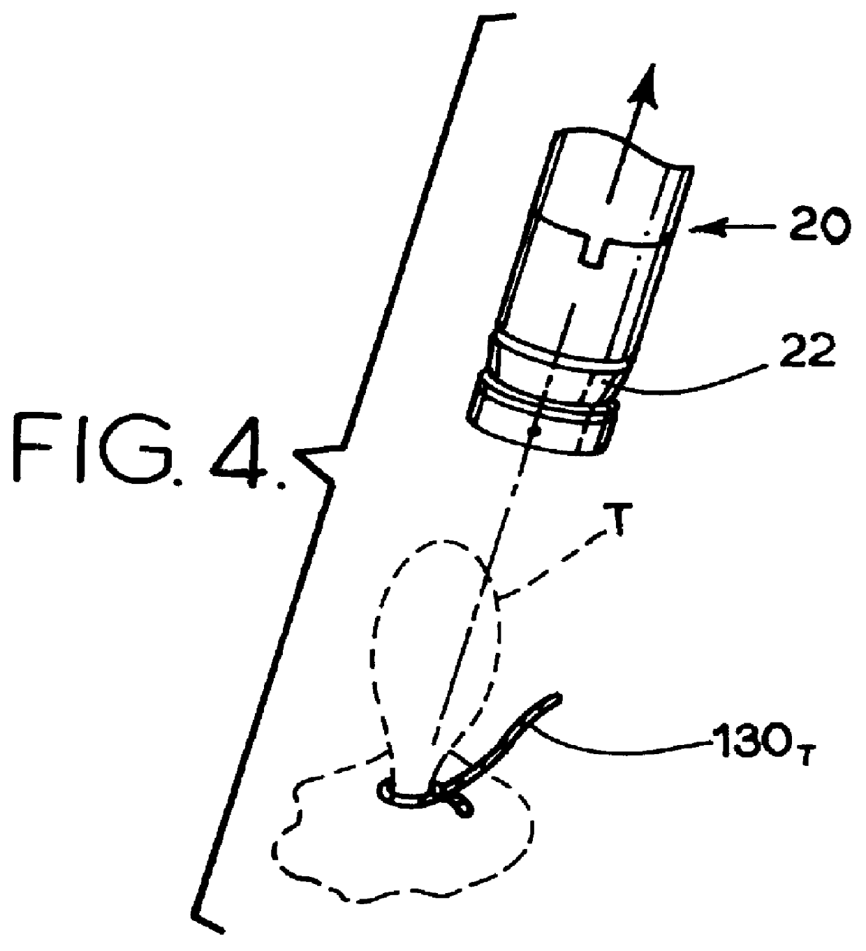 Surgical loop delivery device