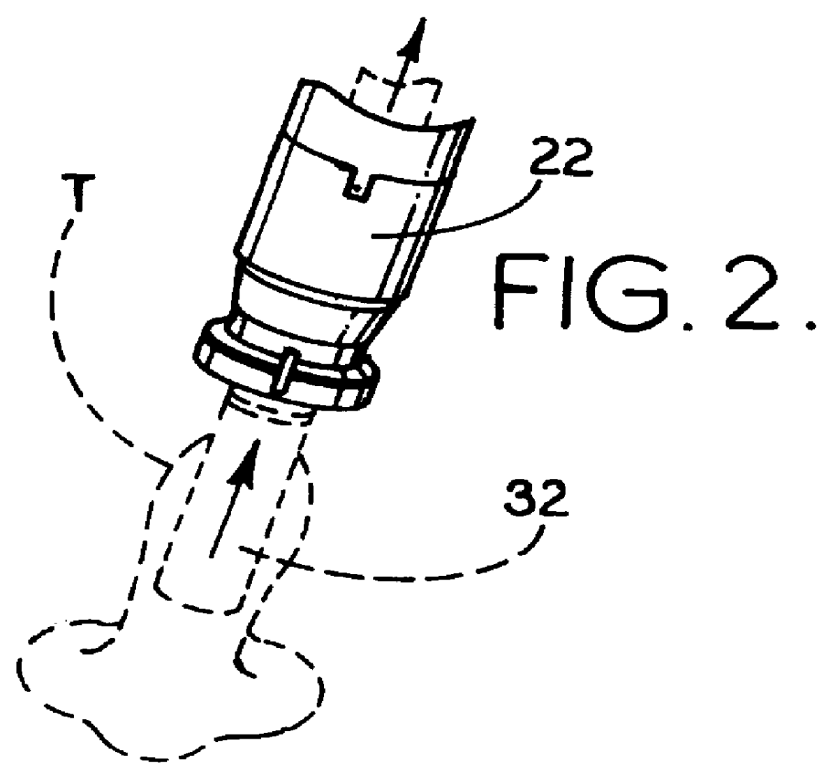 Surgical loop delivery device