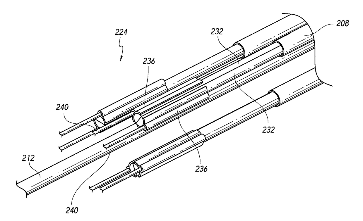 Methods and devices for performing abdominal surgery