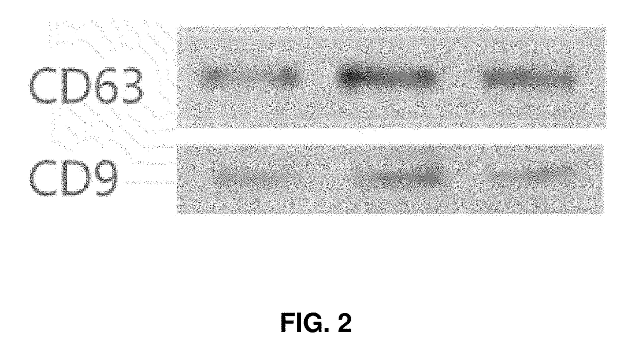 Method for treating an inflammatory brain disease comprising administering a stem cell-derived exosome