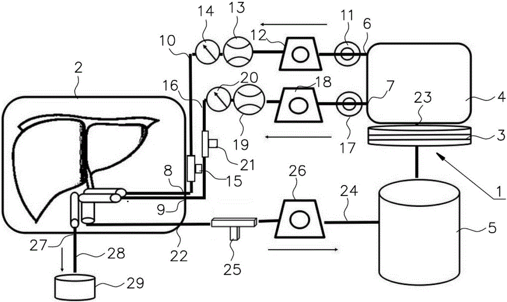 Isolated liver perfusion system and method