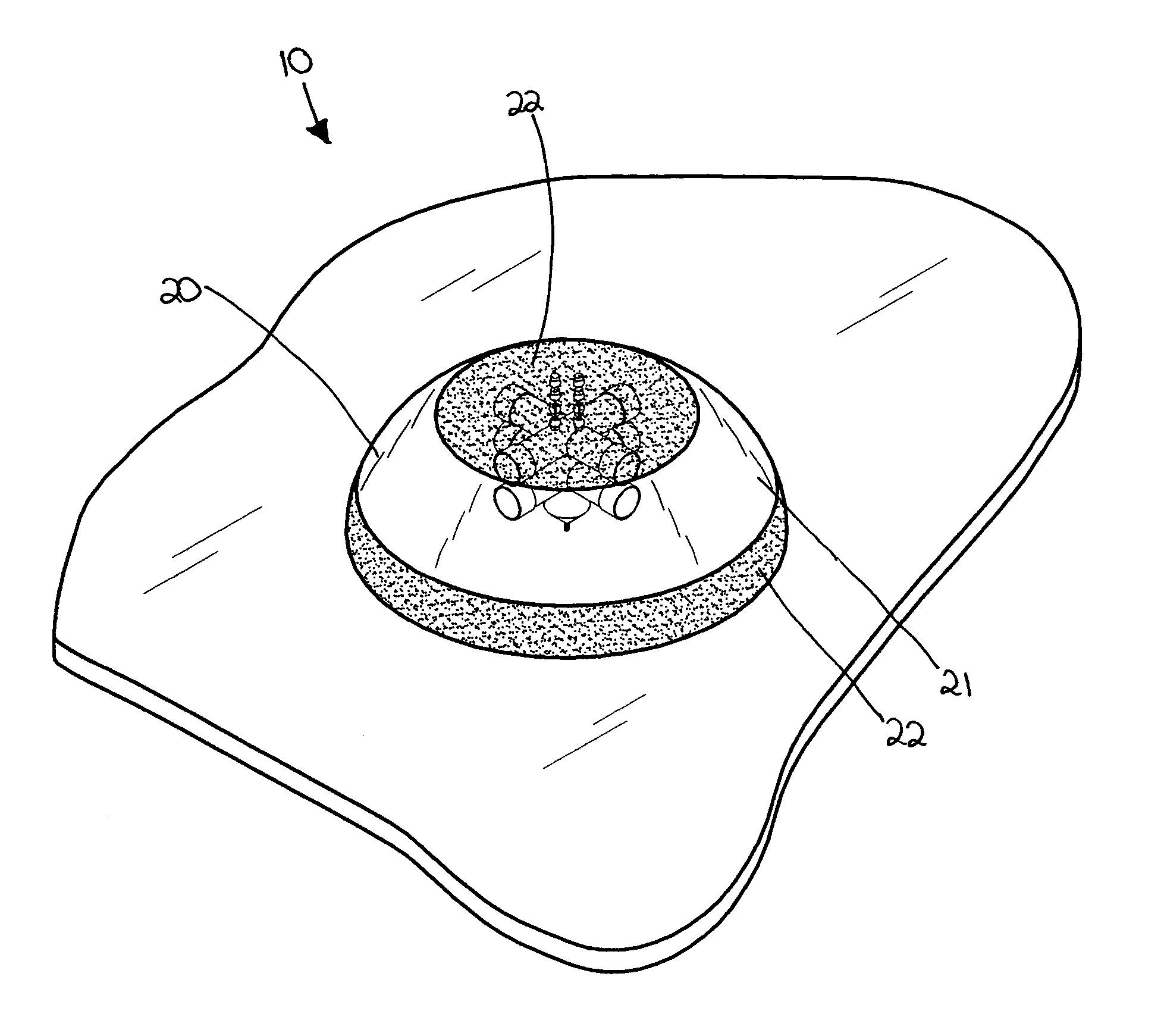 Vehicle mounted surveillance system