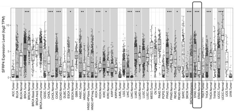 Application of SFRP4 as gastric cancer prognosis marker