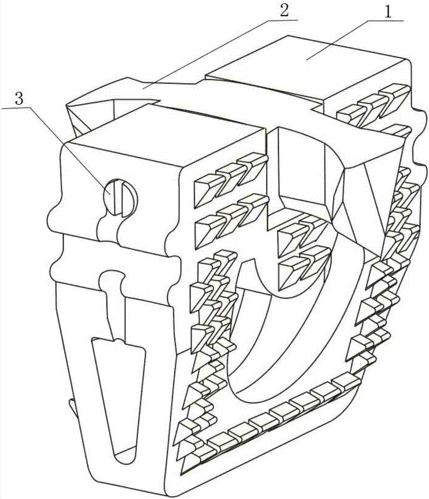 Mortise and tenon type cervical vertebra intervertebral fixer