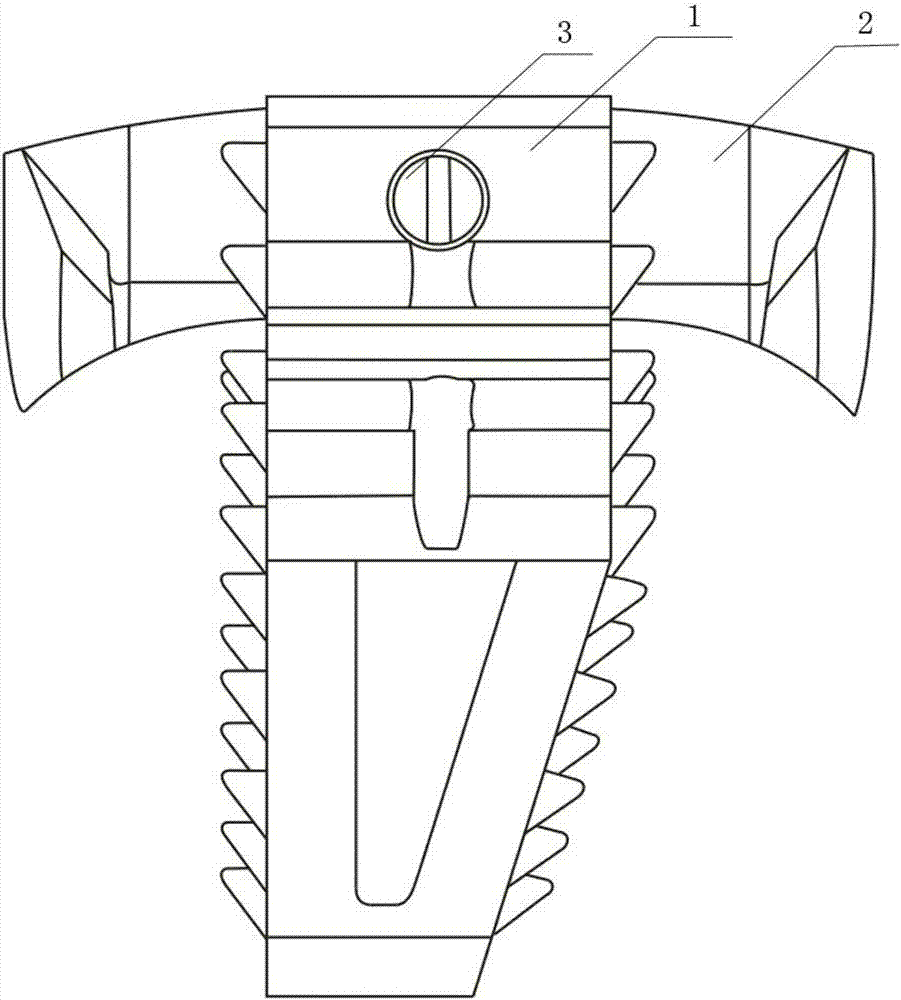 Mortise and tenon type cervical vertebra intervertebral fixer