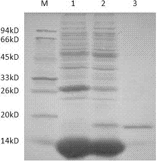 A gAd gene of porcine globular adiponectin and protein encoded by gAd gene and application