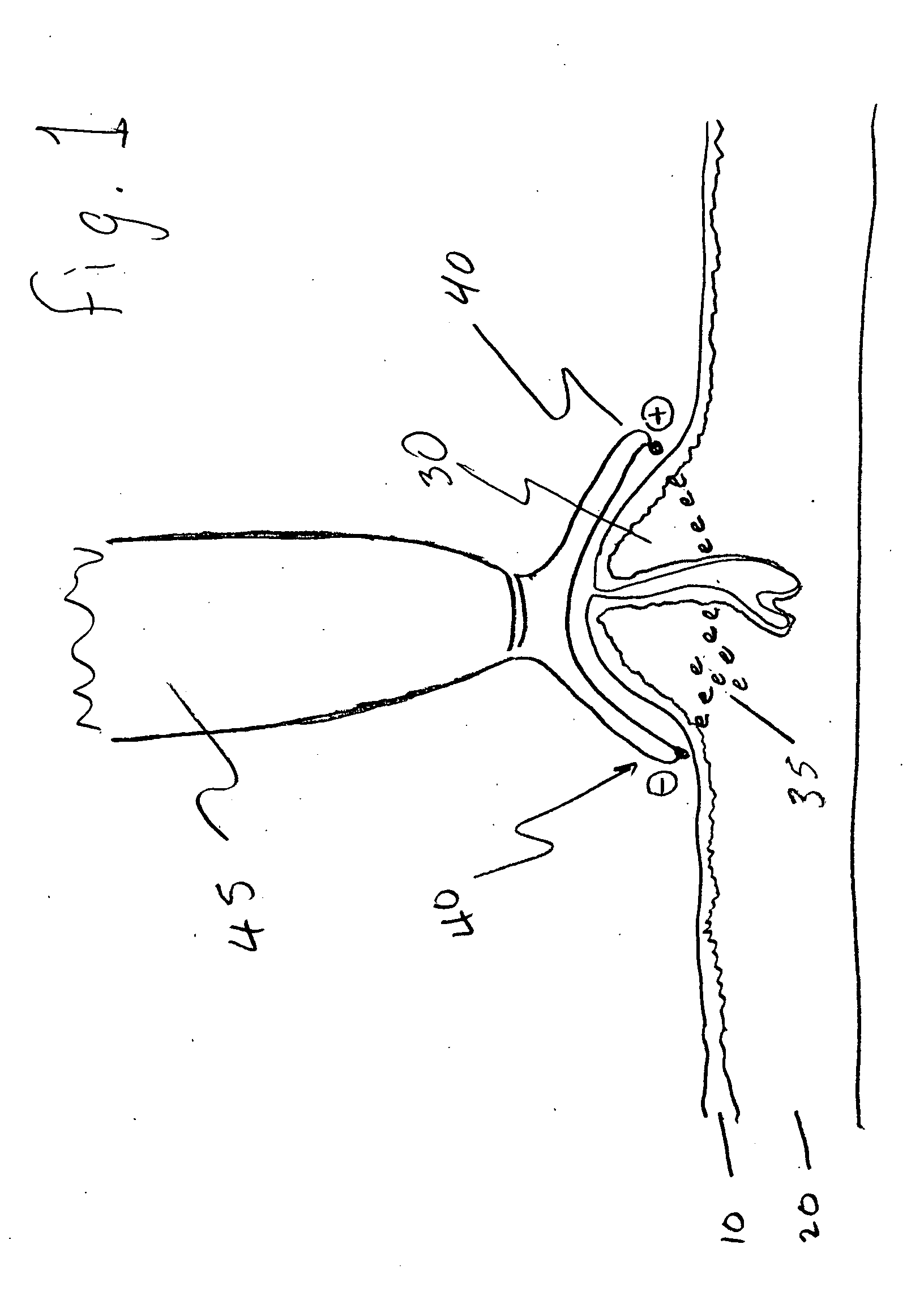 Acne and skin defect treatment via non-radiofrequency electrical current controlled power delivery device and methods