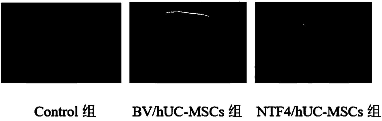 Umbilical cord mesenchymal stem cells modified by NTF4 (neurotrophin 4) gene and construction method and application thereof