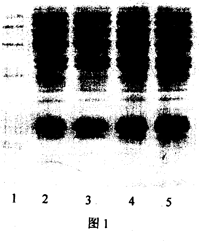 Method for producing recombinant human granulocyte colony stimulating factor