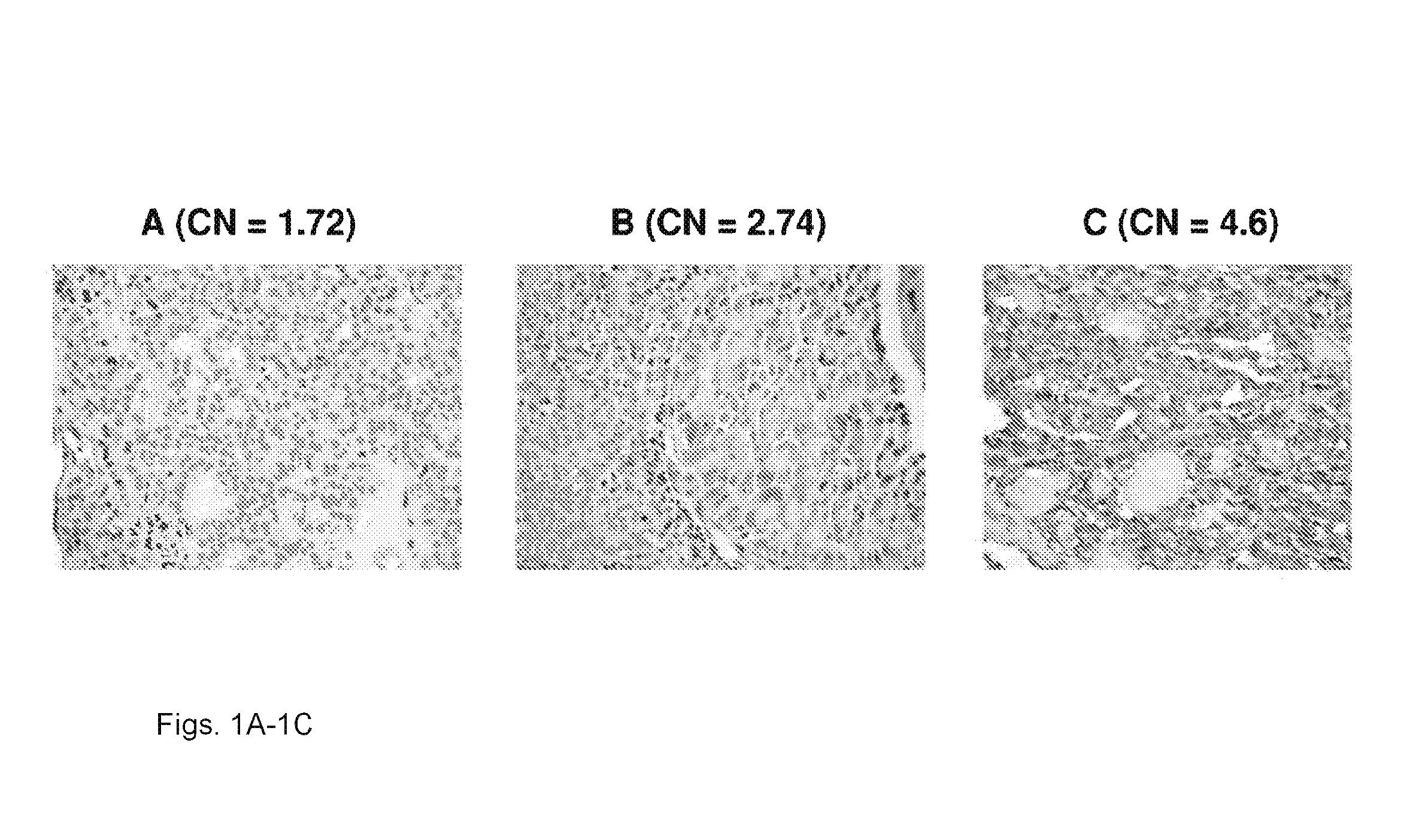 Genetic amplification of IQGAP1 in cancer