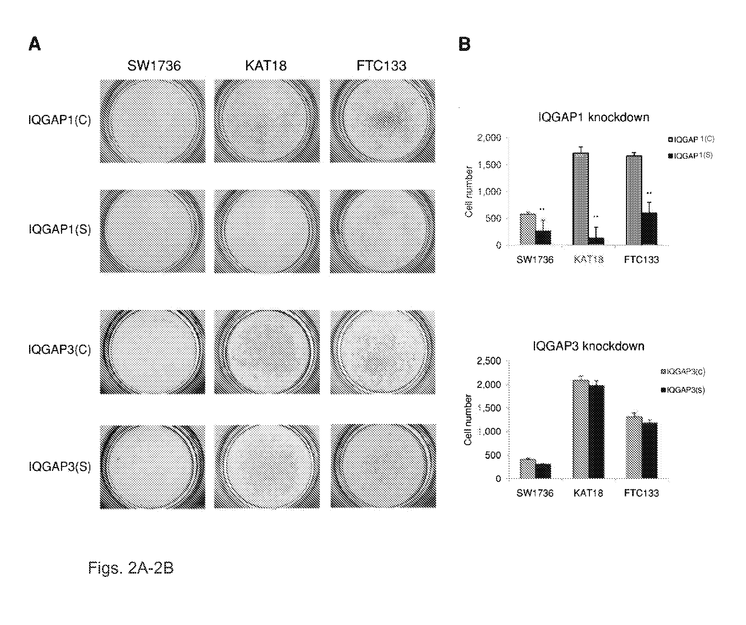 Genetic amplification of IQGAP1 in cancer