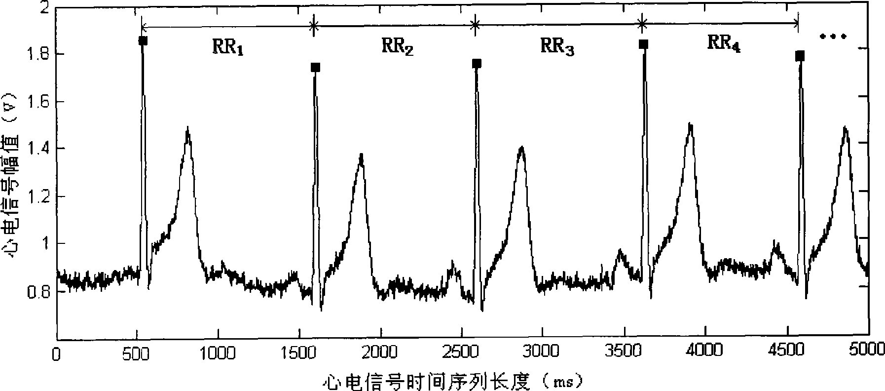 Method and device for detecting heart failure based on electro-cardio interval sequence normalization histogram