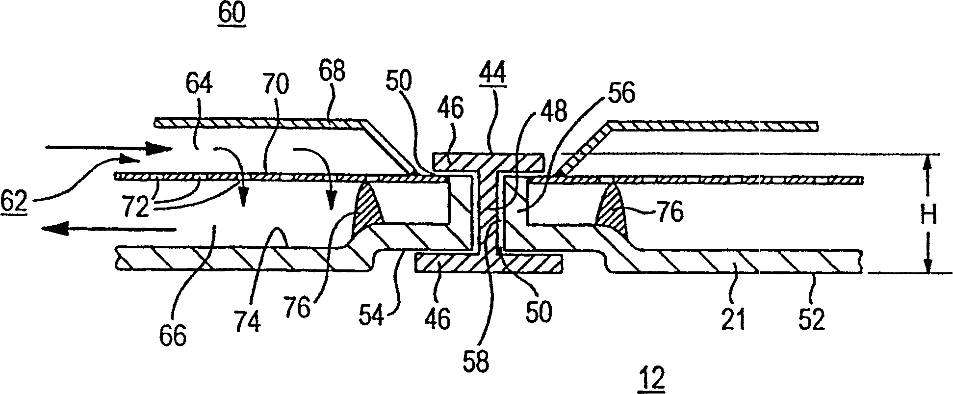 Turbine