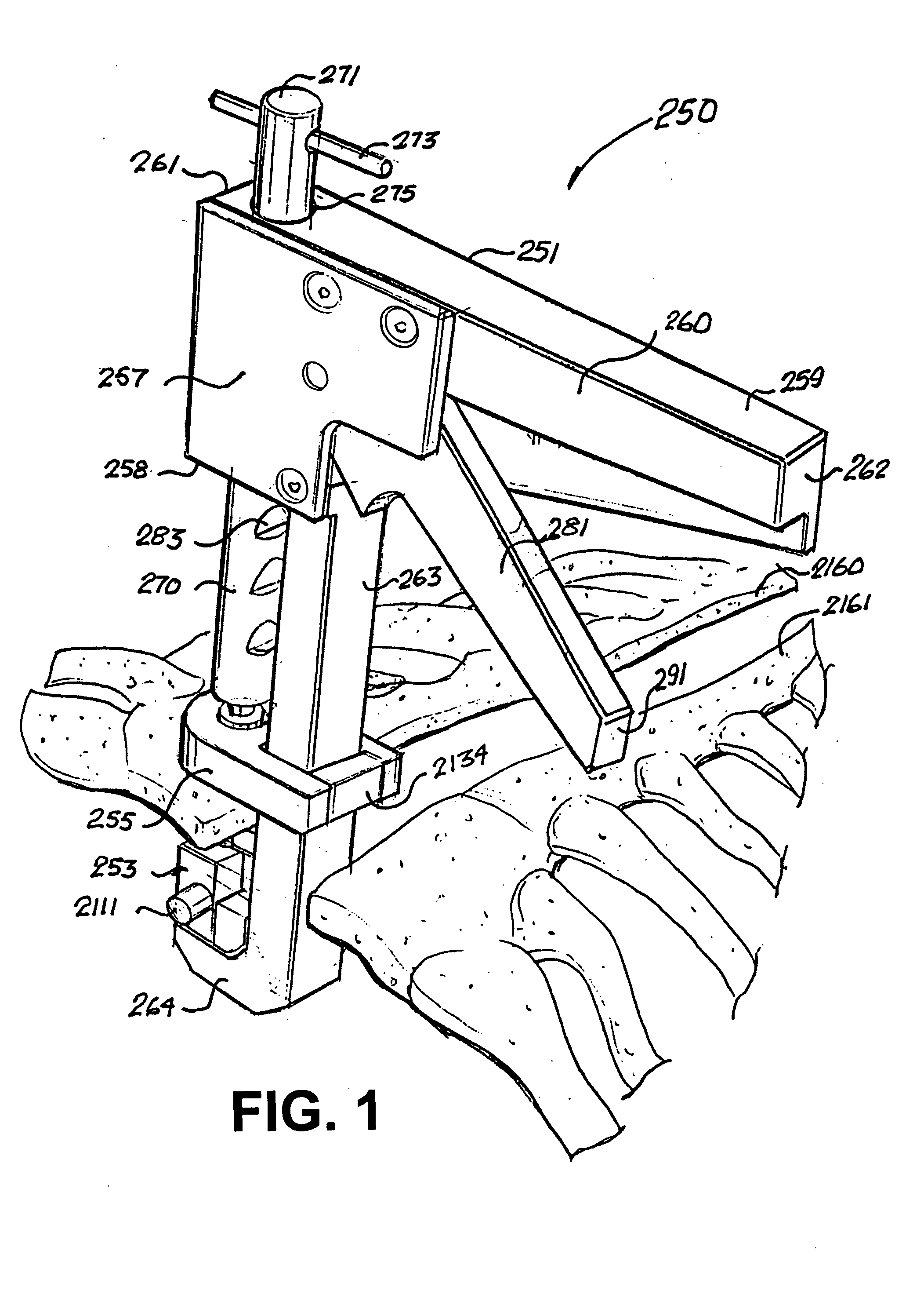 Suture apparatus and method for sternal closure