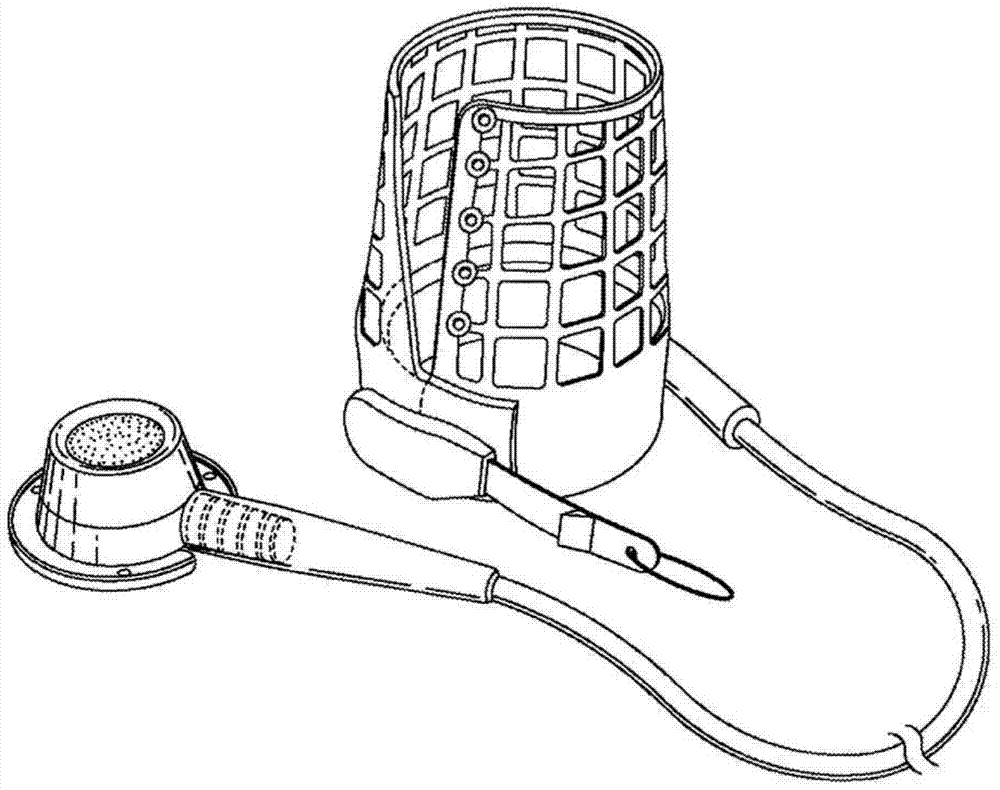 Gastric bands for reducing obstructions