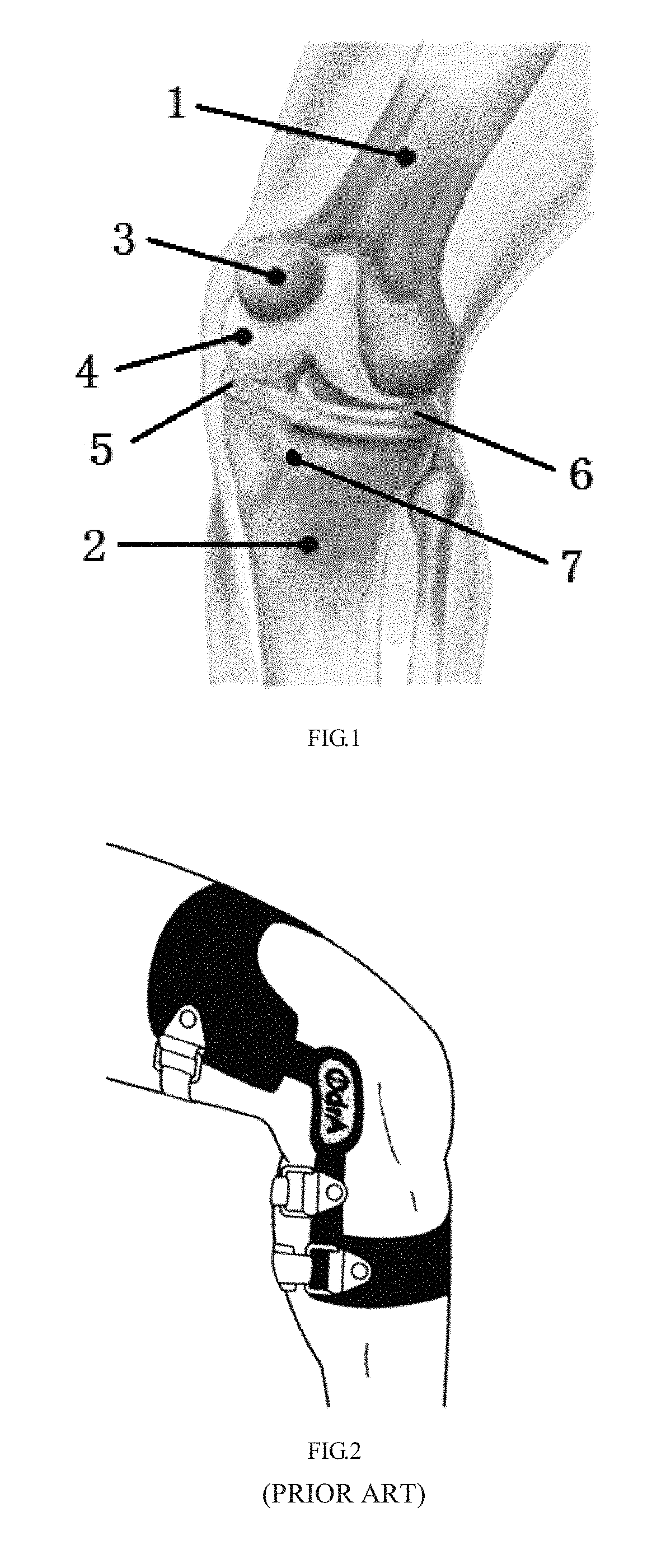 Knee joint orthosis